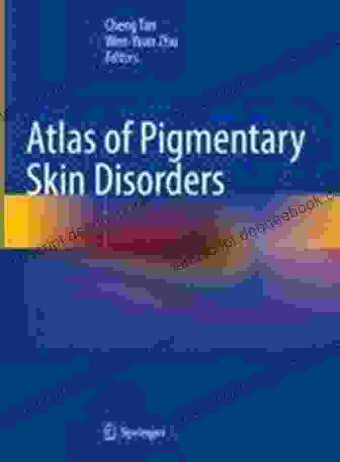 Atlas Of Pigmentary Disorders By Stephanie Snow Atlas Of Pigmentary Disorders Stephanie J Snow